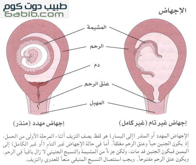 تنزيل الجنين 20160819 3828 1