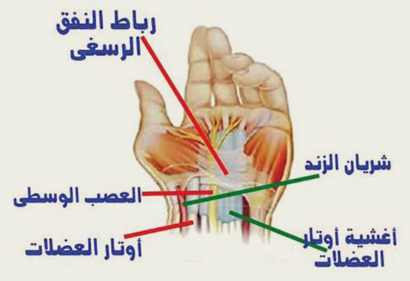 علاج النفق الرسغي بالاعشاب 20160818 428 1