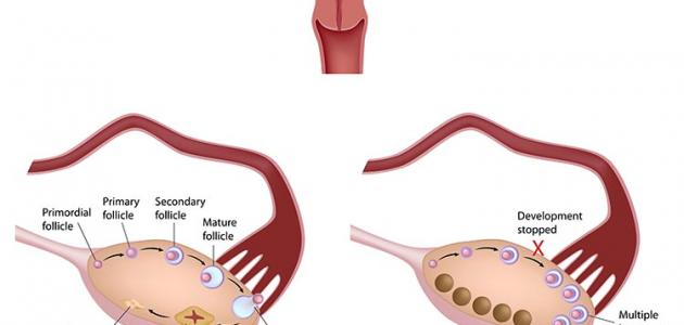 سبب الم المبايض 20160821 1598 1
