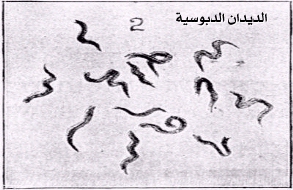 بالصور علاج الديدان الدبوسية عند الكبار