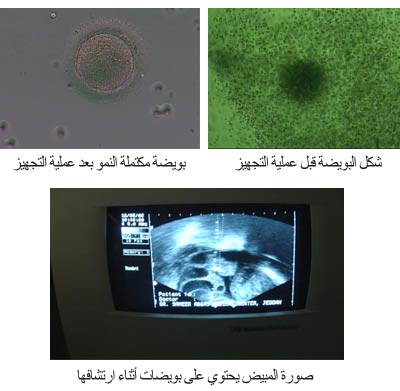 الابر المنشطه تحت الجلد 20160819 1704 1