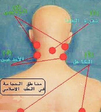 الكاهل والاخدعين بالصور