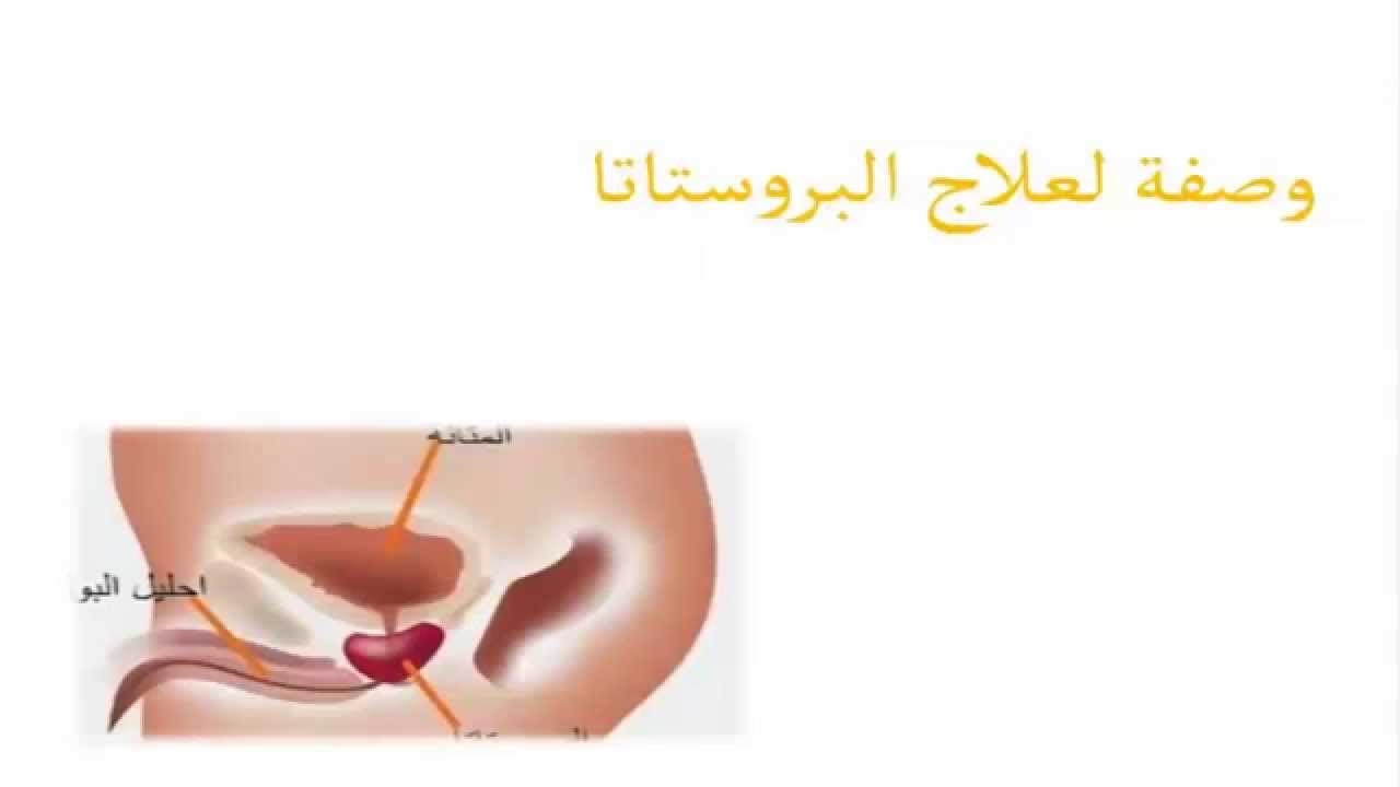 علاج البروستاتا في الطب النبوي