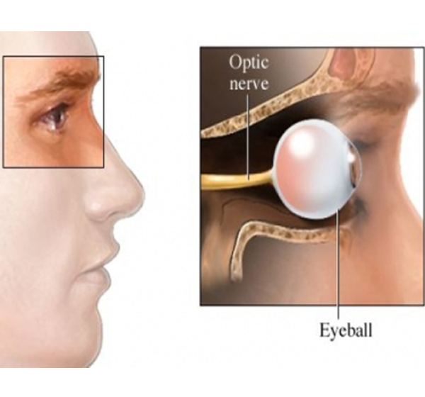 اعراض العصب البصري 20160819 5556 1