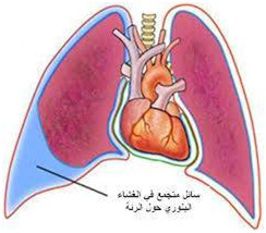 ماء الصدر