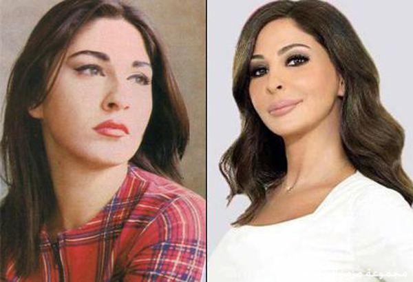 الفنانات قبل عمليات التجميل