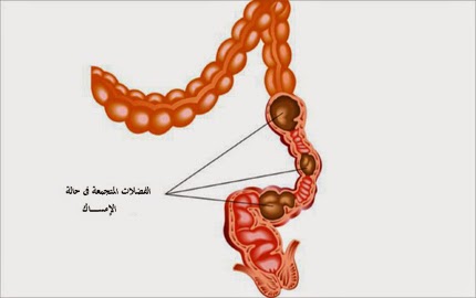 بالصور خلطة لتنظيف القولون من الردب