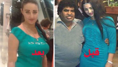 صور صفيناز قبل عمليات التجميل 20160818 1205