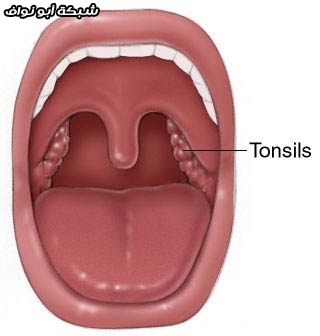 اللوزتين ورائحة الفم